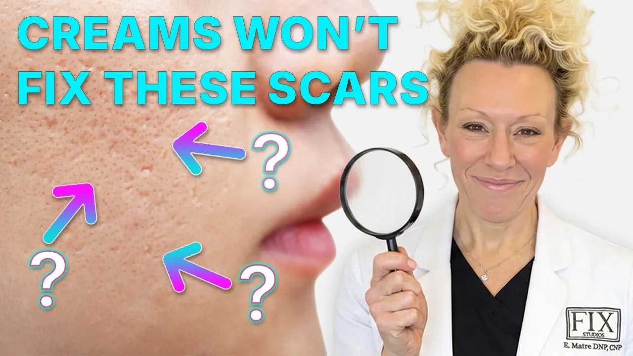 Remove Acne Scars Texture and Redness with These Methods