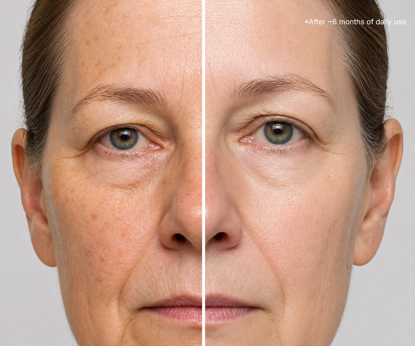 A before and after image of a woman who used Fix Studios medical-grade LustraCe CE+CTP Antioxidant Radiance Serum packed with 20% vitamin C