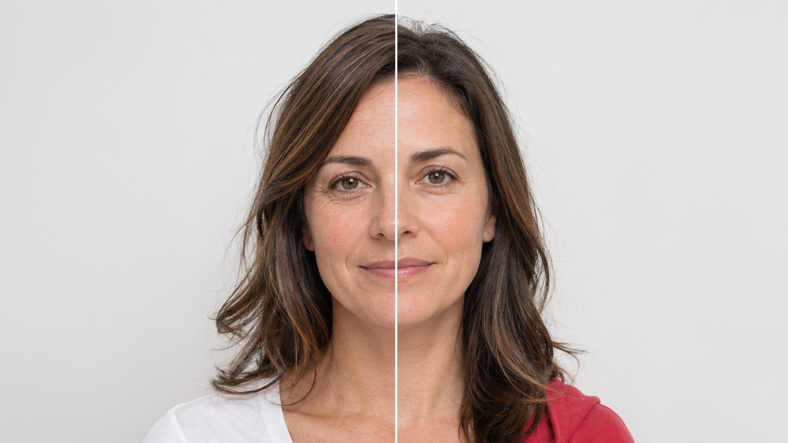 Natural Botox Cincinnati Before & After image of a woman at Fix Studios Cincinnati Mason OH