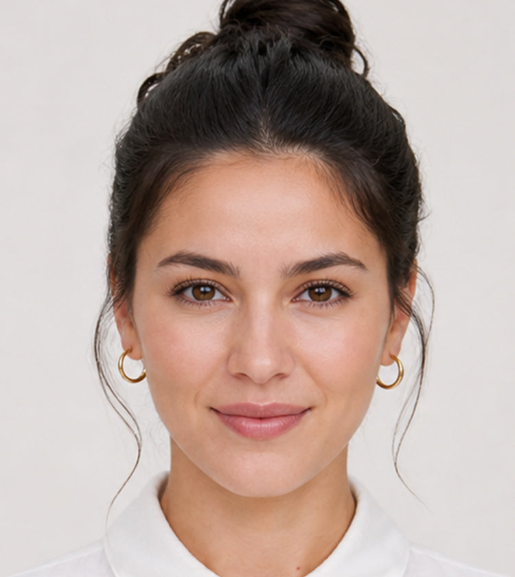 Botox after photo showing relaxed bunny lines and smoother nose-area expression at Fix Studios Cincinnati Mason OH.