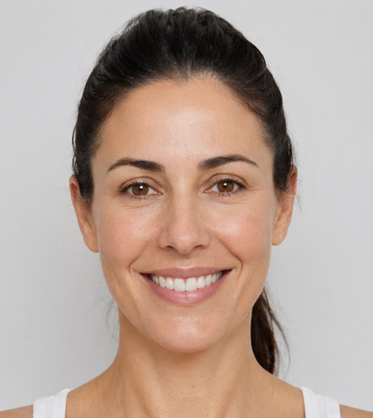 Botox and Lumecca IPL after photo showing softened crow’s feet, brighter-looking skin, and improved tone at Fix Studios Cincinnati Mason OH.