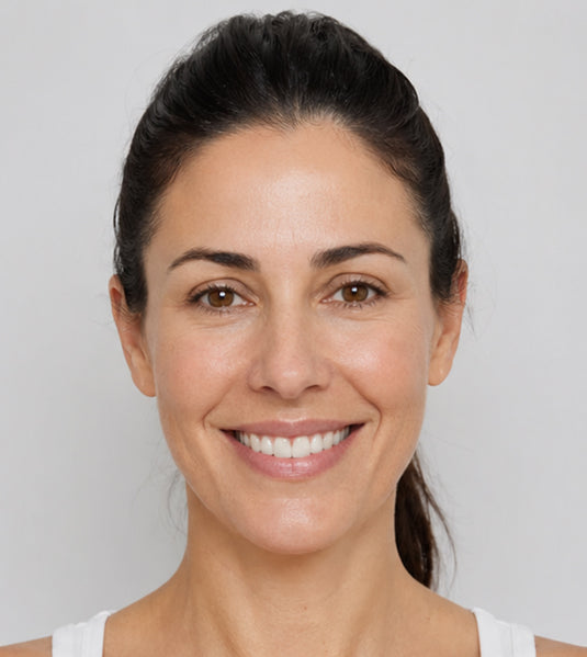 Botox and Lumecca IPL after photo showing softened crow’s feet, brighter-looking skin, and improved tone at Fix Studios Cincinnati Mason OH.