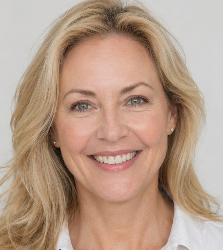 Botox after photo showing softened crow’s feet, smoother forehead lines, and reduced 11s after treatment at Fix Studios Cincinnati Mason OH.