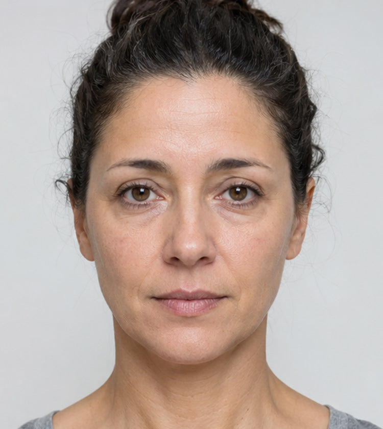 Botox before photo showing forehead lines, 11s between the brows, and natural brow position before treatment at Fix Studios Cincinnati Mason OH.