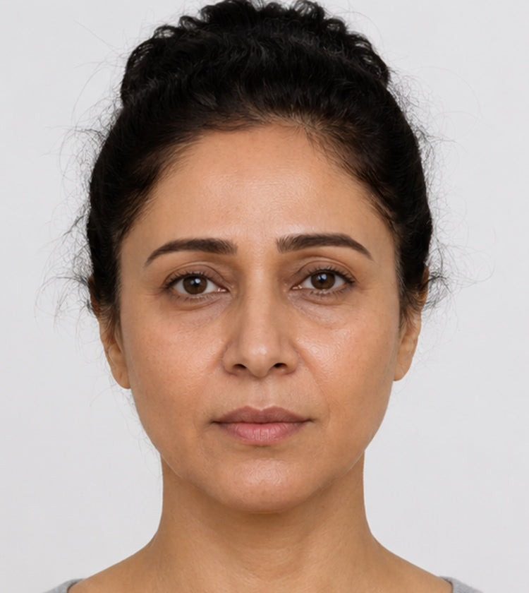 Botox before photo showing natural brow position and skin tone before eyebrow lift treatment and Fix Studios Medical-Grade Skincare at Fix Studios Cincinnati Mason OH.