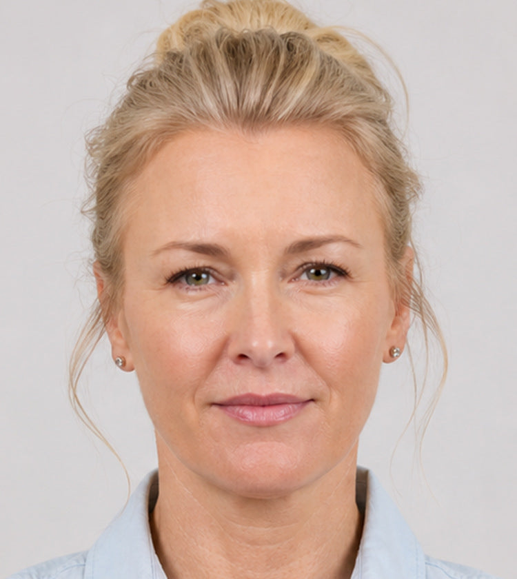 Botox after photo showing smoother forehead skin and softened glabellar 11s after treatment at Fix Studios Cincinnati Mason OH.