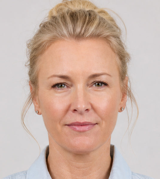 Botox after photo showing smoother forehead skin and softened glabellar 11s after treatment at Fix Studios Cincinnati Mason OH.