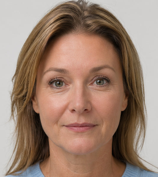 Botox after photo showing smoother forehead wrinkles and a refreshed upper-face result at Fix Studios Cincinnati Mason OH.