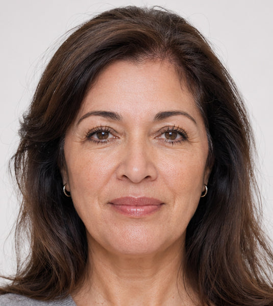 Botox after photo showing softened horizontal forehead lines and natural-looking upper-face smoothing at Fix Studios Cincinnati Mason OH.