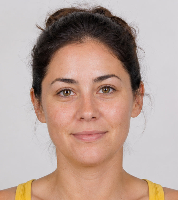 Botox before photo showing natural upper lip shape, skin texture, and upper lip hair before lip flip, microneedling, and laser hair removal at Fix Studios Cincinnati Mason OH.
