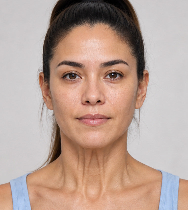 Botox before photo showing visible vertical platysmal neck bands before treatment at Fix Studios Cincinnati Mason OH.