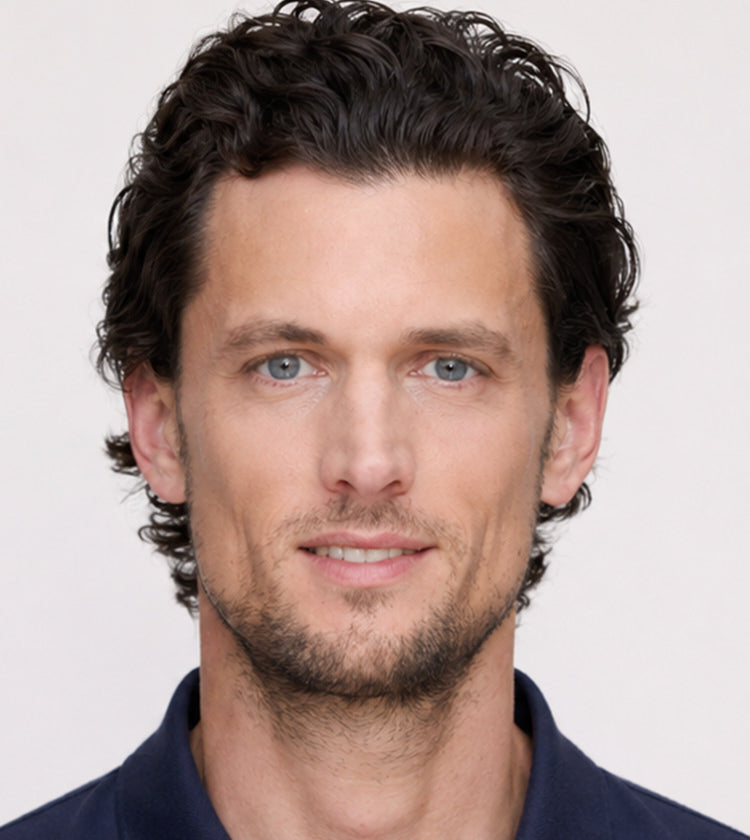 Botox after photo of a male patient showing smoother forehead lines, softened 11s, and reduced crow’s feet after treatment at Fix Studios Cincinnati Mason O