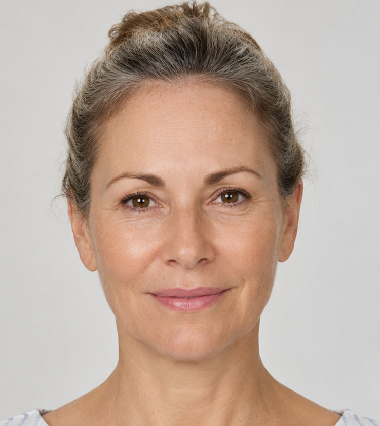 Botox after photo showing smoother forehead, softened 11s and crow’s feet, plus a subtle lip flip result after treatment at Fix Studios Cincinnati Mason OH.