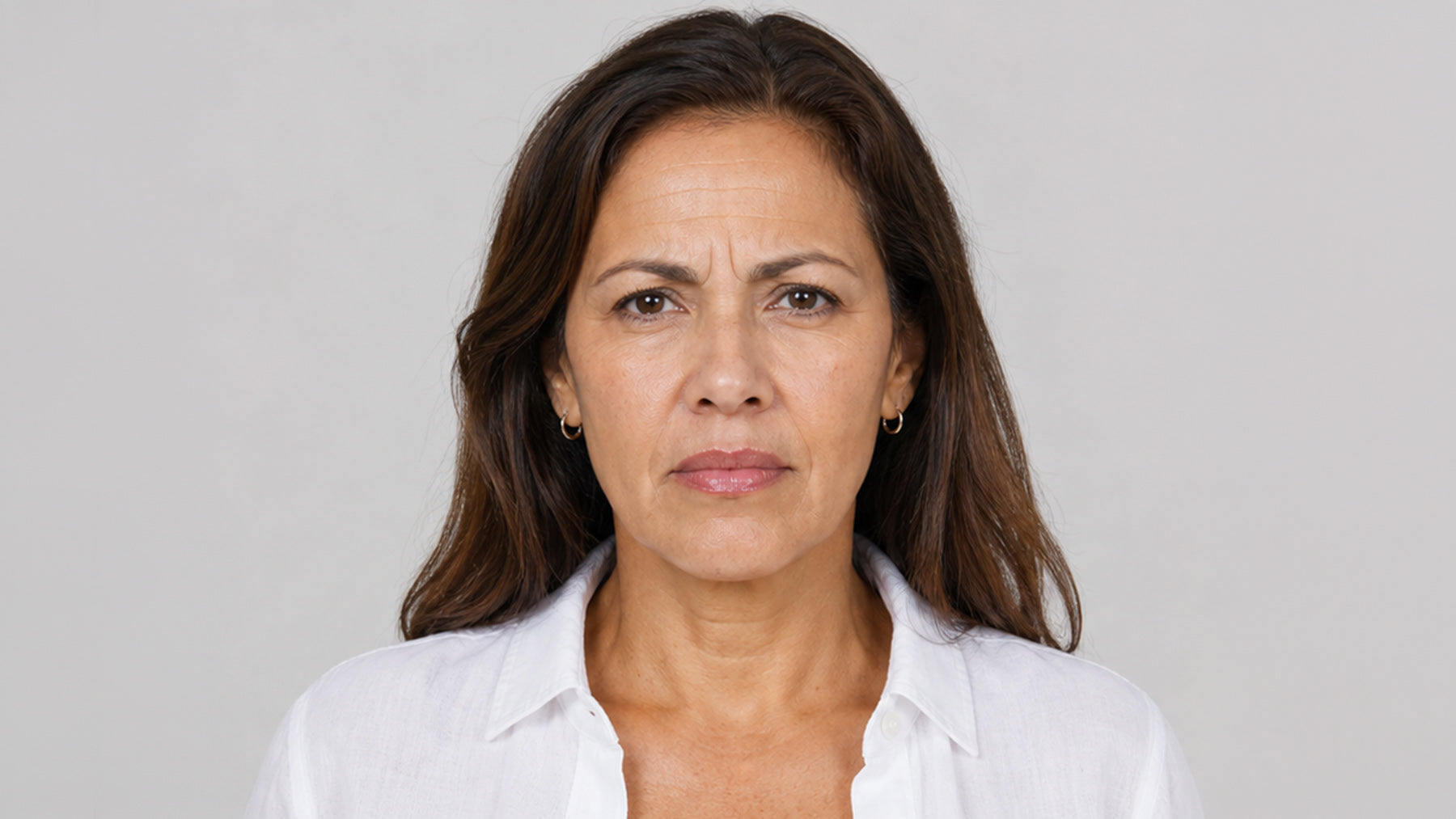Botox treatments and services before and after fix studios medspa cincinnati mason OH