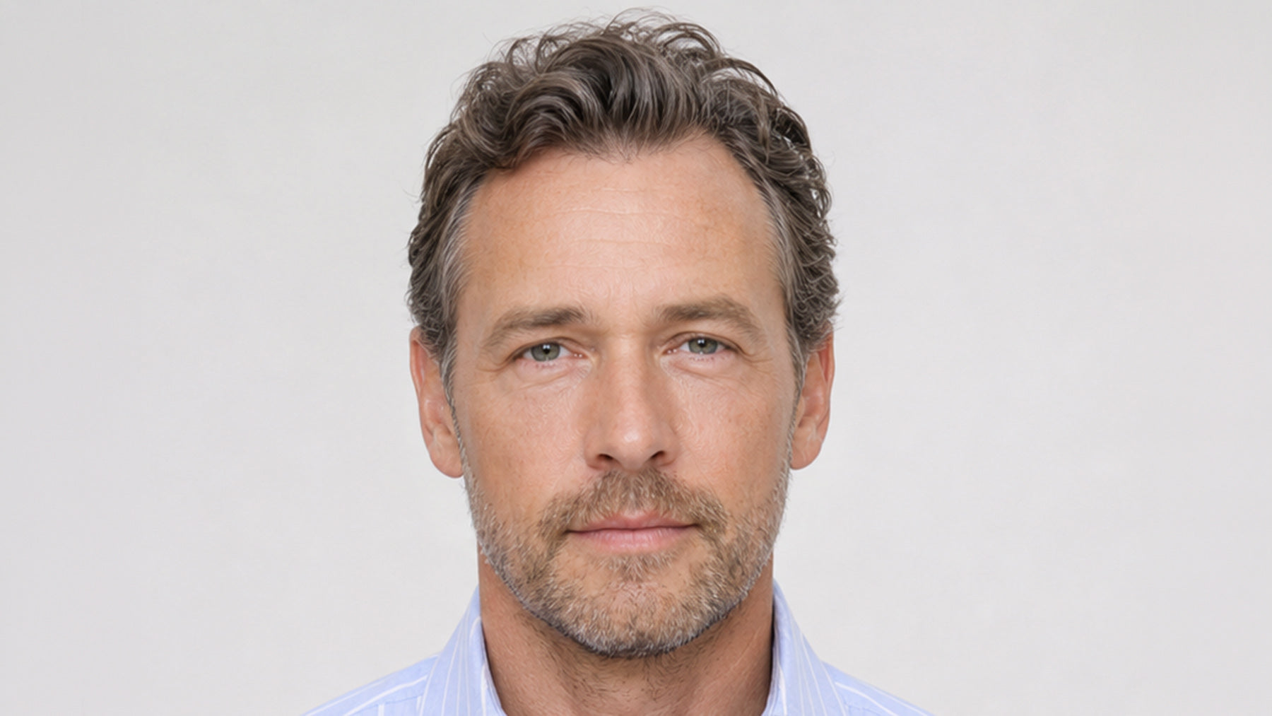 An after image of Botox for men treatments and services before and after fix studios medspa cincinnati mason OH