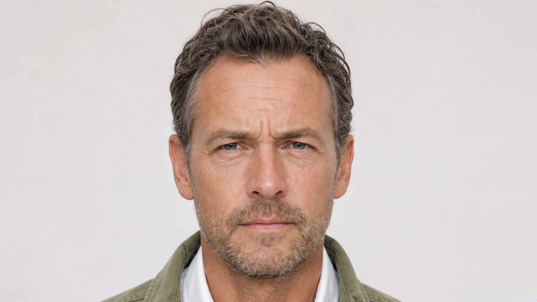 A before image of Botox for men treatments and services before and after fix studios medspa cincinnati mason OH