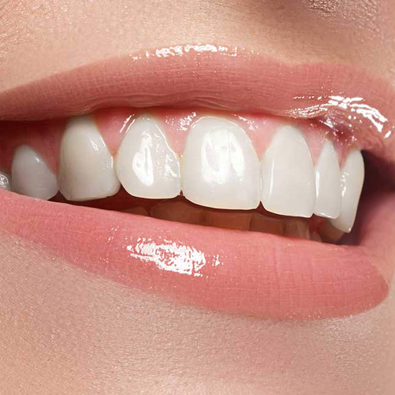 A woman smiles showing her bright white after receiving professional teeth whitening treatments at Fix Studios medspa in Cincinnati Mason OH